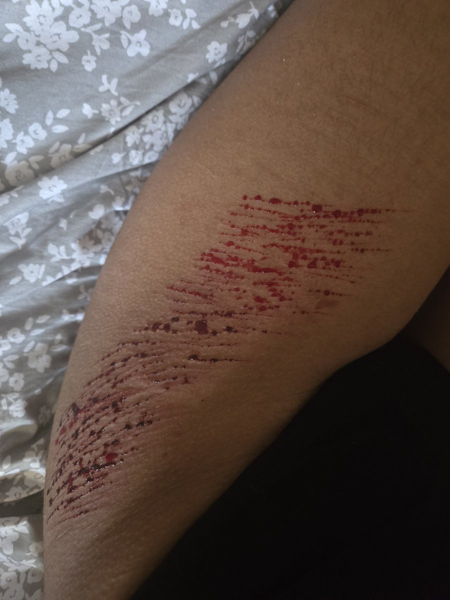 _Gho5tly_'s tweet photo. #shtwt #slittwt #sh #selfharm #cutting #shedtwt #slashflash
ALL SFX MAKEUP NOT REAL AI GENERATED HALLOW MAKEUP
I honestly didnt expect there to be this much fake blood tbh idk why some of it is already scabbing its so weird but might do more later https://t.co/lJURU5wCGx