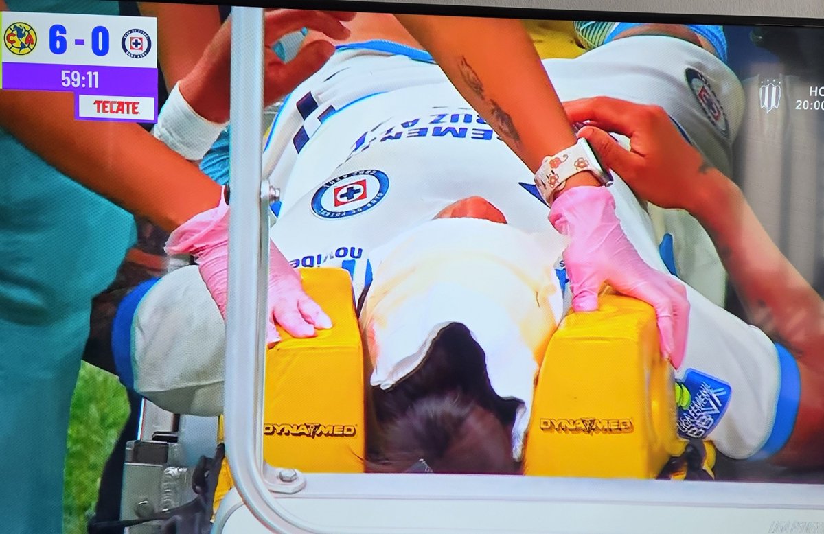 RadarFem's tweet photo. Durante el segundo tiempo del encuentro @AmericaFemenil ante @AzulFemenil, la jugadora @Lizangeles109 sufrió un duro golpe en el rostro tras disputar el balón con @scarnefer, por lo que tuvo que abandonar el partido.

Le deseamos pronta recuperación. https://t.co/Cis4skxEfB