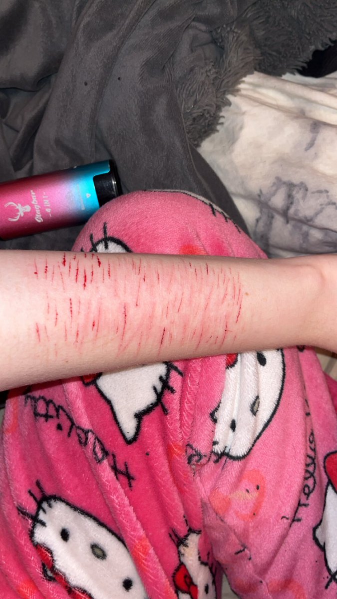 runningbl00d's tweet photo. ‼️SFX MAKEUP ALL FAKE‼️

I found my old blade and it was like a Kai razor #shedrtwt #shtwt #988twt https://t.co/AAd8hkWmW2