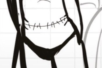 FreyaPaceFan4's tweet photo. @hellacalico Genuine question, what’s that big scar around her belly?? https://t.co/Oip70Y1tCw
