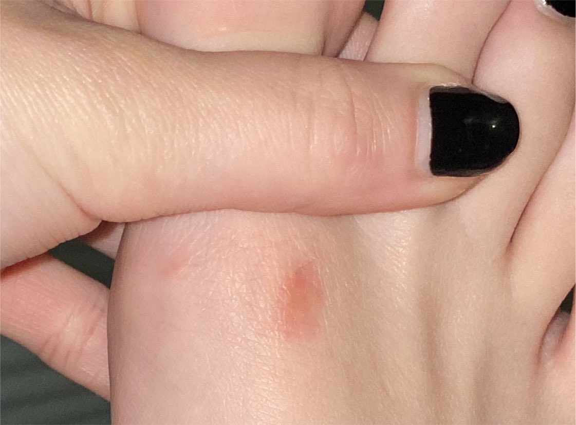 Cursevictimm's tweet photo. @creampufkitty Girl I wish I knew sorry im no help💀💀mine doesn’t hurt as bad anymore but u get used to the pain https://t.co/uzV6UkhffW