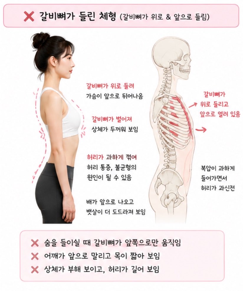 ye0nduuu's tweet photo. 애들아 갈비뼈가 넓고 들려 있어서 상체가 뭔가 안 예뻐 보이는 친구들 있니

나도 예전에는 배에 힘을 빡 주고 다니면 코어 잡는 거라고 생각했는데 오히려 배를 계속 집어넣고 힘주면서 호흡하면 갈비뼈가 들리는 보상이 생길 수 있더라구

특히 숨쉴 때 갈비뼈가 앞쪽으로 확 들리고 허리가 같이 꺾이는 느낌이 있다면
배를 더 세게 집어넣는 게 아니라 힘을 조금 빼고 갈비뼈가 옆이랑 뒤쪽으로도 넓어지게 호흡하는 것이 중요해!!

코어 잡는다고 하루 종일 배 집어넣고 다니지 말자…🥹
배에 힘 = 배를 납작하게 집어넣기 ❌
자연스럽게 몸통을 지지하면서 호흡하기!!! ⭕
