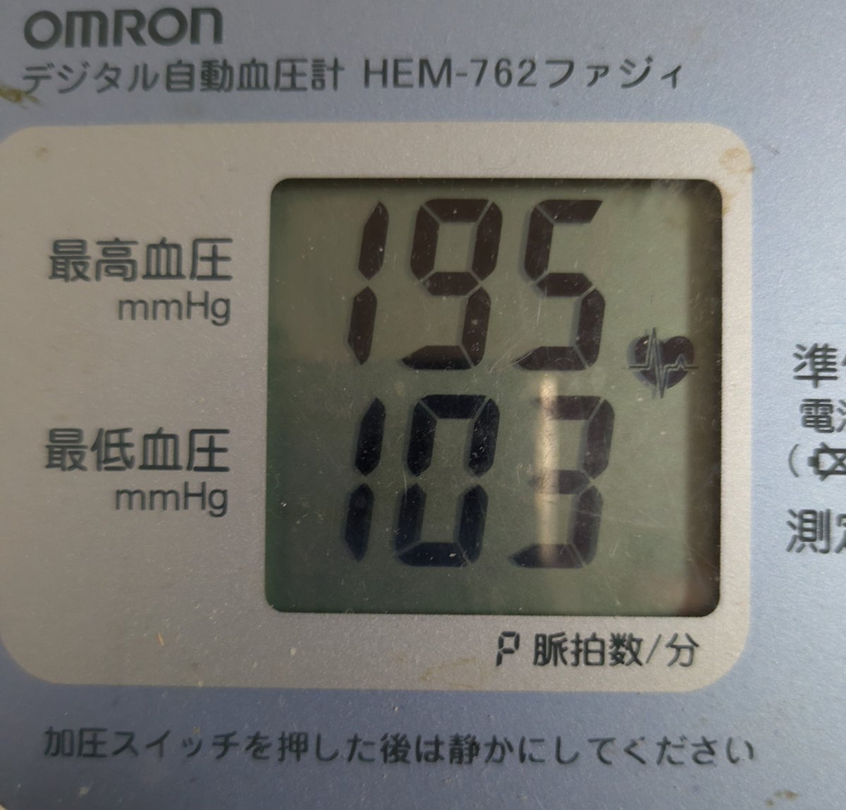 retaliationgobl's tweet photo. ちょっと塩分とりすぎるとこれだわ
また水がぶ飲みで対処しなくちゃ https://t.co/JtFp8vLM71