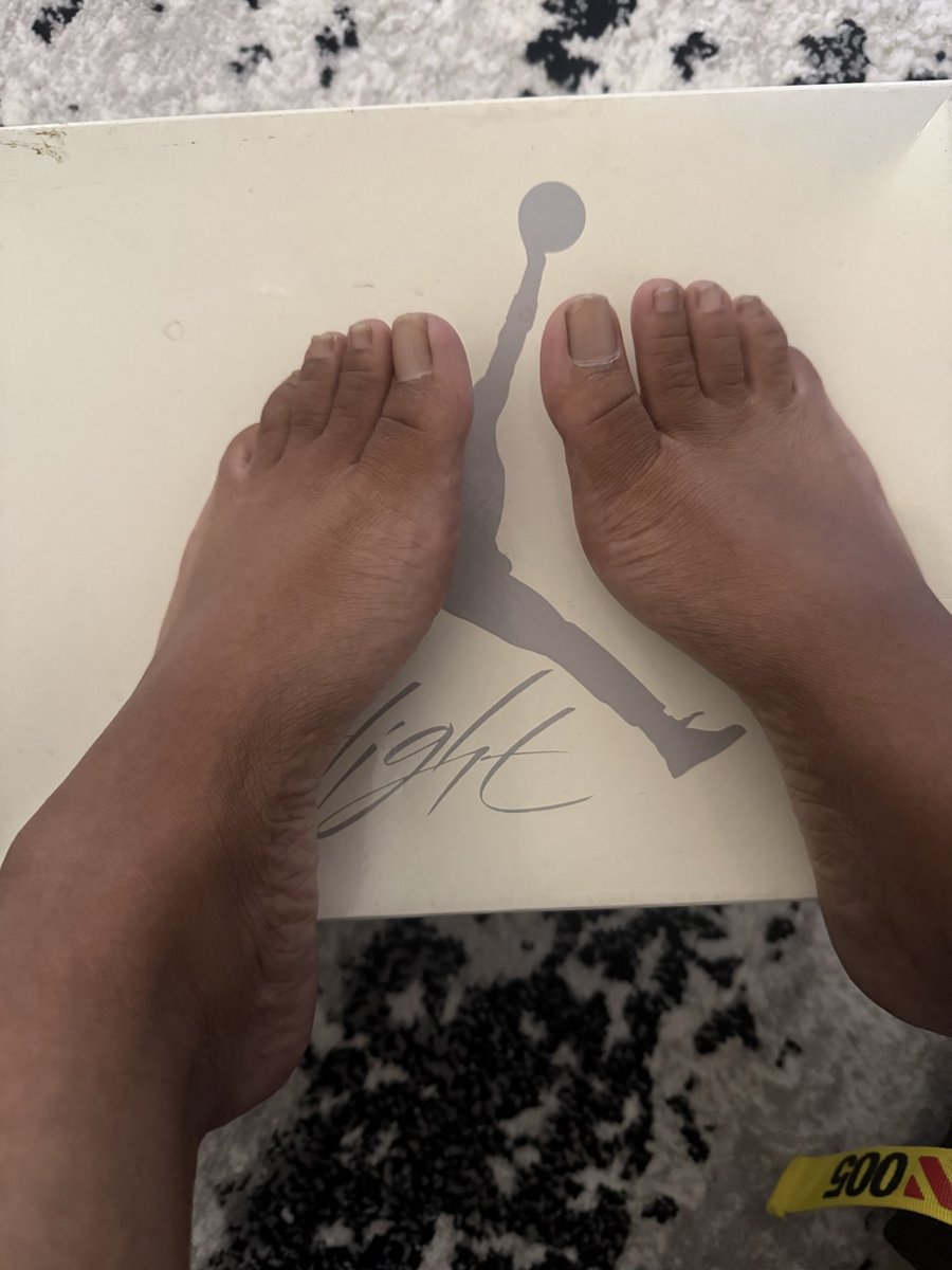 stud4you5's tweet photo. Need a pedicure https://t.co/6aC4NylxxO