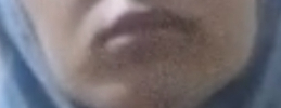 Tropical8zn's tweet photo. @meowmeow6924 @NMalick09 Nice cope, your eye area is subhuman. Inb4 low IQ cope https://t.co/LxQpf18HzT