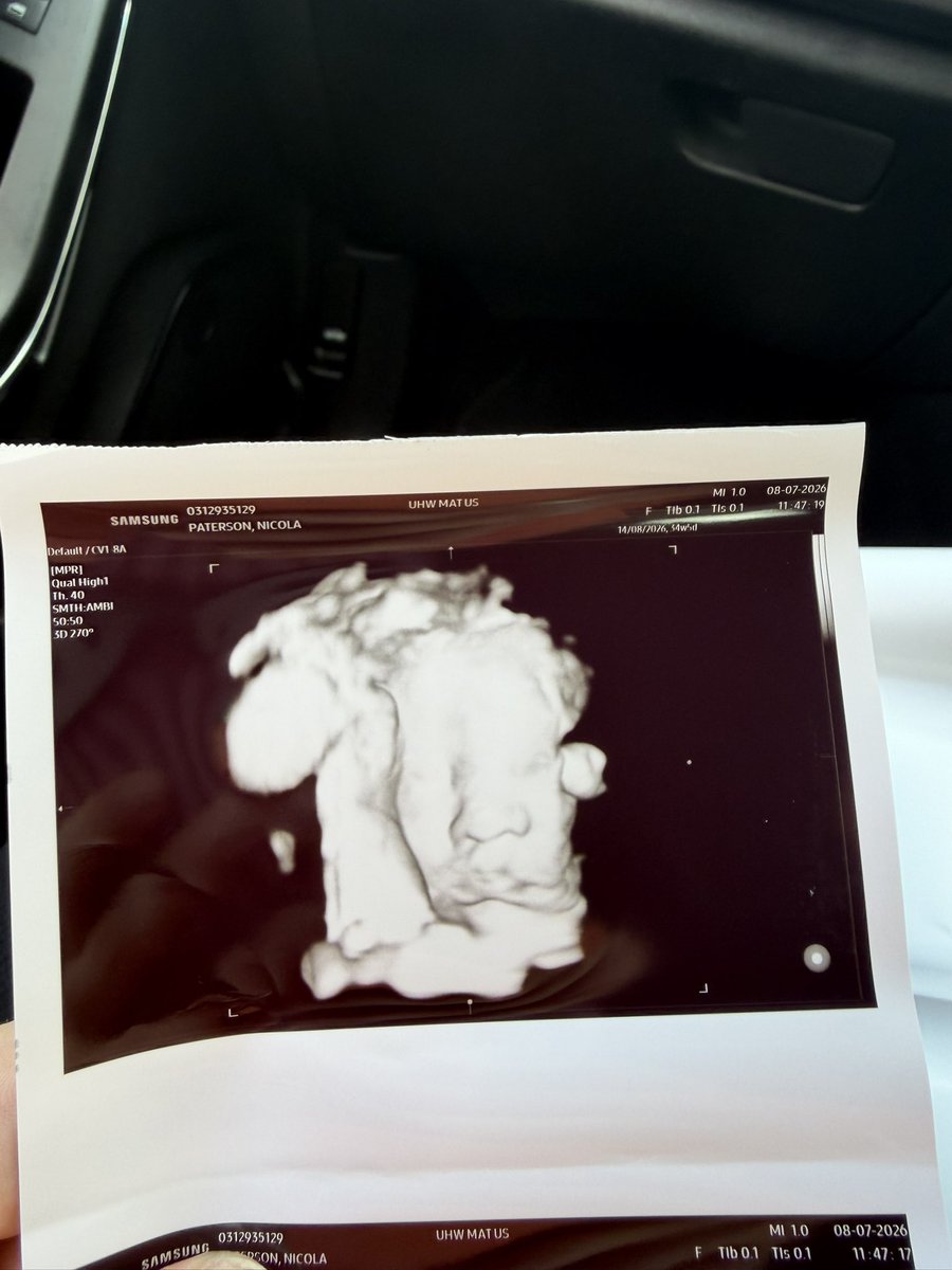 NikkiMcNeil1's tweet photo. Life recently ✨ soaking up the last moments of life as a 3 ♥️🐾 not long until we become 4 🧸 https://t.co/DIephEWBOQ