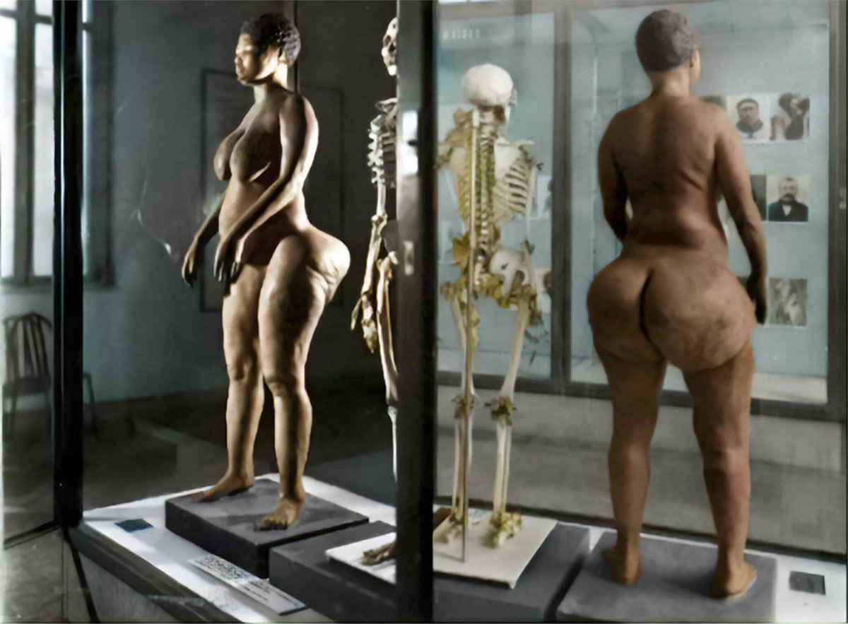 DaniMayakovski's tweet photo. El 9 de agosto de 2002, 187 años después de su muerte, se devolvían a Sudáfrica los restos de la esclava negra Saartjie Baartman, que fue secuestrada y exhibida de manera humillante por los zoos humanos en Europa.

Su dolorosa historia recuerda el sufrimiento de las mujeres negras africanas a manos de los monstruos colonos blancos racistas occidentales y la brutalidad de la esclavitud que perpetraron.

Baartman nació en Sudáfrica en 1789, allí era esclava de una plantación y totalmente analfabeta, cuando fue vendida en 1810 al colono británico William Dunlop, que vio la oportunidad de hacer un zoo humano y exhibirla en una jaula como a un "simio".

En Londres, fue exhibida por Dunlop en un zoo humano encerrada en una jaula, donde se le obligaba a mostrarse desnuda a los blancos y por un módico precio, se les permitía tocarla y agredirla sexualmente delante de cientos de hombres.

El maltrato a Saartjie en Londres fue tal, que hubo hasta protestas en las calles para detener aquel trato humillante y acabó incluso en un juicio por tortura, el criminal racista que la compró, William Dunlop, le prometió la libertad si declaraba en el juicio que no había sido maltratada, Sara accedería a ello.

Tras librarse de la condena, el esclavista Dunlop incumplió su promesa y vendió a Saartjie a otro criminal, un domador de bestias francés que la exhibió en otro zoo humano durante 15 meses en París, llegando a violarla y dejándola embarazada.

En 1815, en uno de sus humillantes exhibiciones en Paris, atrajo la atención de científicos franceses, en particular la de George Cuvier, que vio un "ejemplar" perfecto para demostrar teorías supremacistas blancas de que "los negros provienen de los simios y son inferiores a los blancos".

Saartjie fue comprada por Cuvier... pero de nuevo, para ser exhibida como un animal en la prestigiosa Academia Real de Medicina de París, donde le obligaban a mostrarse desnuda ante un centenar de científicos entre comentarios como "No he visto nunca una cabeza humana tan parecida a la de un simio".

A finales del año 1815, tras sufrir todo tipo de abusos durante 5 años, Saartjie Baartman terminó vagando absolutamente sola por las calles de Paris, en la indigencia, enferma y con el cuerpo destrozado, muriendo el 29 de diciembre de 1815 con solo 25 años.

Aun después de muerta seguían humillandola, el científico francés Cuvier realizó un vaciado en yeso de su cuerpo, su esqueleto, su cerebro y sus genitales estuvieron en exposición pública en el Museo del Hombre de París durante más de 160 años.... hasta 1994 no se dignó Francia a retirar sus restos del público y no fue hasta 2002 que fue repatriada y enterrada en Sudáfrica.

Los colonialistas británicos y franceses la mataron en solo 5 años de haber salido de África, a base de maltratos, violaciones y humillación psicológica.

Esta es la historia de Saartjie, pero también de muchas millones de mujeres africanas sin nombre, asesinadas y abusadas por el colonialismo occidental... esos mismos que hoy hablan de invasiones de inmigrantes y que dicen que no pueden acoger a gente que no respeta su cultura, bueno esta su cultura.