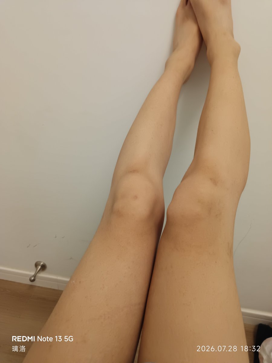 arieryn's tweet photo. 腿照 https://t.co/xJux3GPKTu