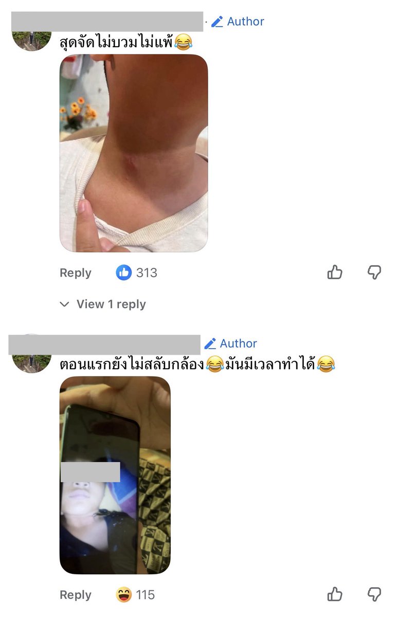 iTakkung's tweet photo. ละน้องปลอดภัยดี ไม่มีอาการแพ้ ทายาทอสูรคุณยายวรนาถมาเองป่ะ 😂 https://t.co/09QaaBK9wc
