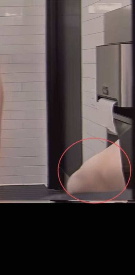 imbangwool's tweet photo. @lo_lipopp @KawaiiGuku back of his arm 😭 https://t.co/VdzJsWLkl6