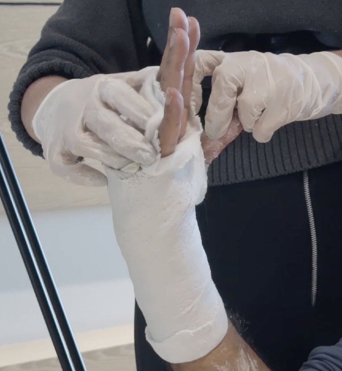 CMMSProAI's tweet photo. https://t.co/EVMPaYWmYO recently provided excellent guidance in a complicated case where a thumb contracture, coupled with thumb, MCPJ &amp; PIPJ stiffness was present. 
The CMMS technique is very effective at reducing MCPJ stiffness.
In this image you can see Robyn Midgley providing https://t.co/gDkAGLwNca
