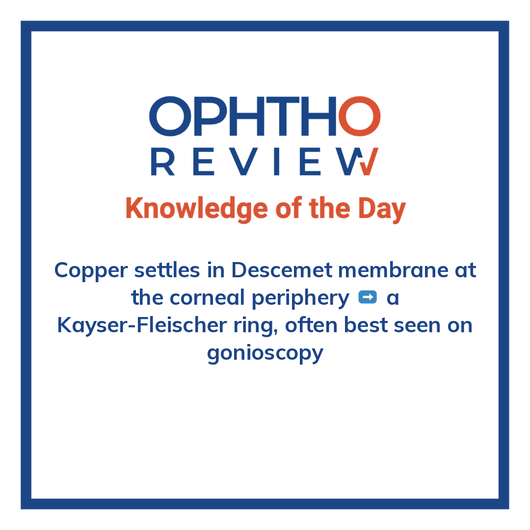 ophthoreview's tweet photo. Wilson disease

#ophthoreview #ophthalmology #ophtho #ophthalmologyresidency #ophthalmologist #surgicaleducation #medicaleducation #meded #surgery #medicalstudent #medicine #medicalschool #resident #residency https://t.co/g0KVIzQ3HG