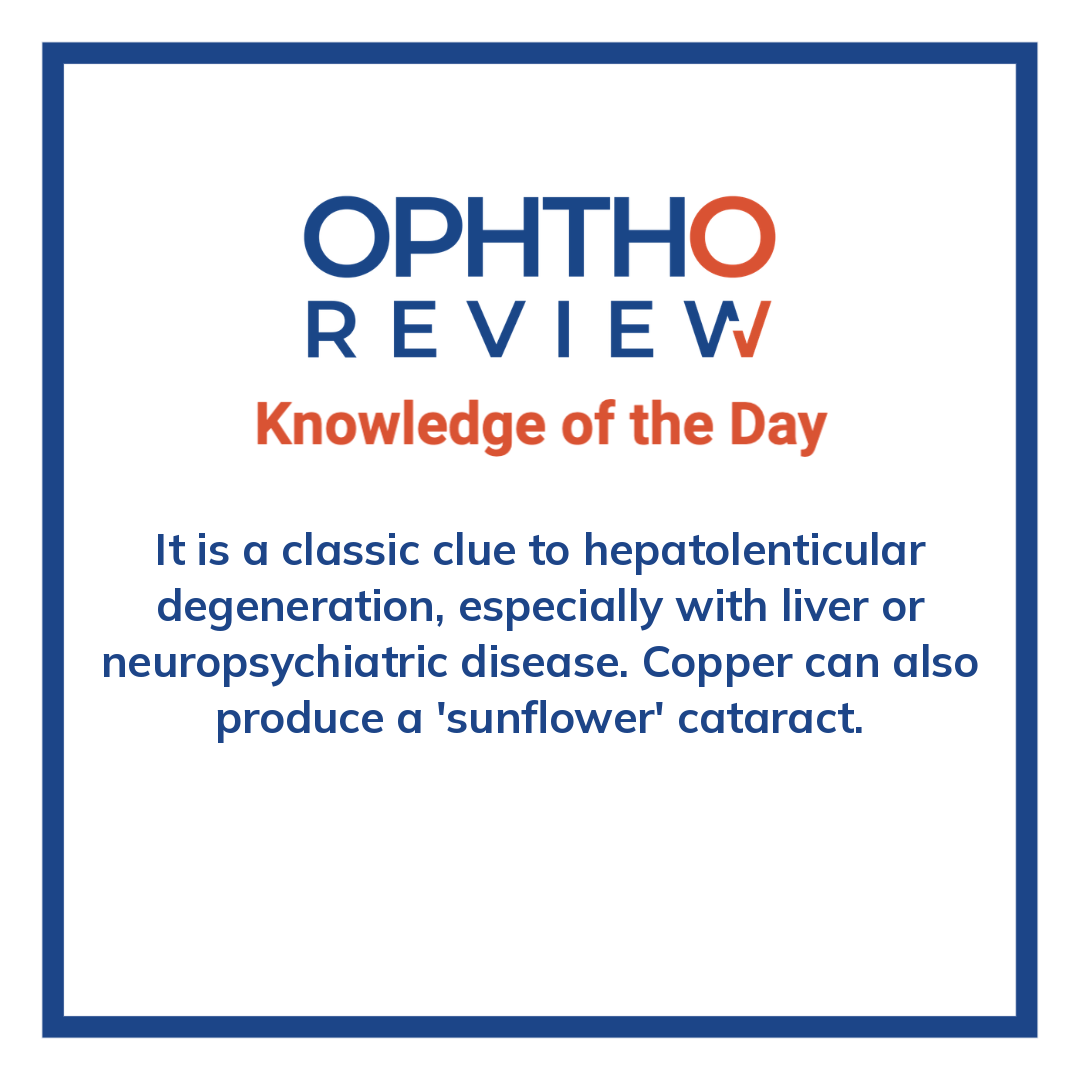 ophthoreview's tweet photo. Wilson disease

#ophthoreview #ophthalmology #ophtho #ophthalmologyresidency #ophthalmologist #surgicaleducation #medicaleducation #meded #surgery #medicalstudent #medicine #medicalschool #resident #residency https://t.co/g0KVIzQ3HG