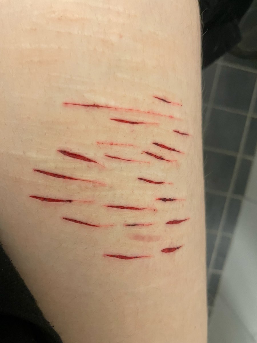 the0pup's tweet photo. Hii tiny sesh with new blade 
All oneswipes! I’m so excited to try multiswiping with these, this was barely any pressure! Also almost threw up after? Don’t know why https://t.co/vKGcEJZAHk