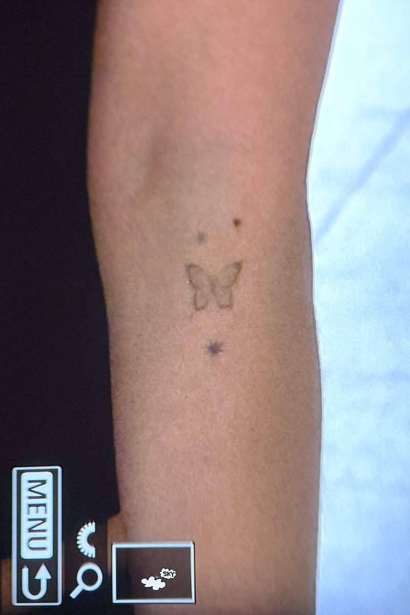 DragonKazoo77's tweet photo. Solar showing off the new butterfly tattoos on her forearm!

Q. Real or stickers?
🐰 Secret 🤫
Q. Why did you choose the butterfly ones?
🐰 There was nothing but butterfly ones

https://t.co/yzg22Gq1ZT
https://t.co/2Gv5G3rcWs