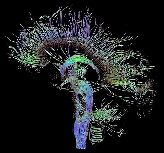 latestincosmos's tweet photo. 🚨: Cannabis protects brain cells ─ not destroy them! 

Decades of research show cannabinoids reduce inflammation and oxidative stress in the brain. https://t.co/kjbvxYEZiK