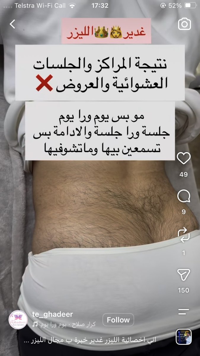 homerguy136's tweet photo. @ussygussy369 Average Lebanese woman before getting her back hair lasered https://t.co/QJZPjUtI8P