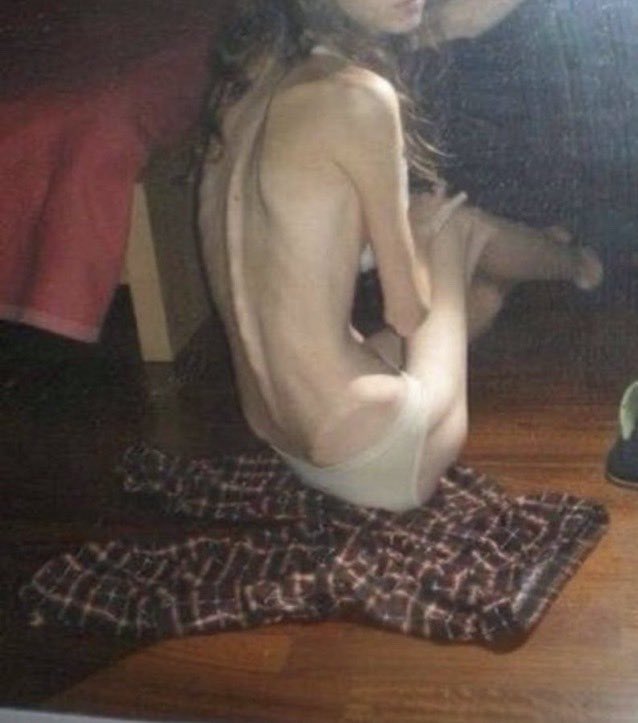 SkinnyAdmirer's tweet photo. #thinspo #thinspO0 #bonespo #bonesp0 #deathspo #deathsp0 #edtwt #anablur #edtw #twana #twed #edblur #edtblur #ed #anatw #proana https://t.co/3oRjlntQG6