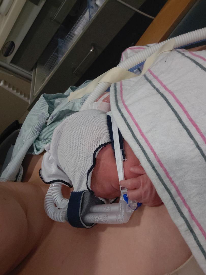 ChoiceForTwo's tweet photo. Congrats to Mama Leana on the safe delivery of her baby boy!
Leana’s Baby Registry still has some items that need to be purchased…if you can help us #probirth, check out the link below!! ☺️
https://t.co/kalf3HFSzI
#praisegod #lifewins #abortionismurder https://t.co/Ky0Ptp0lSt