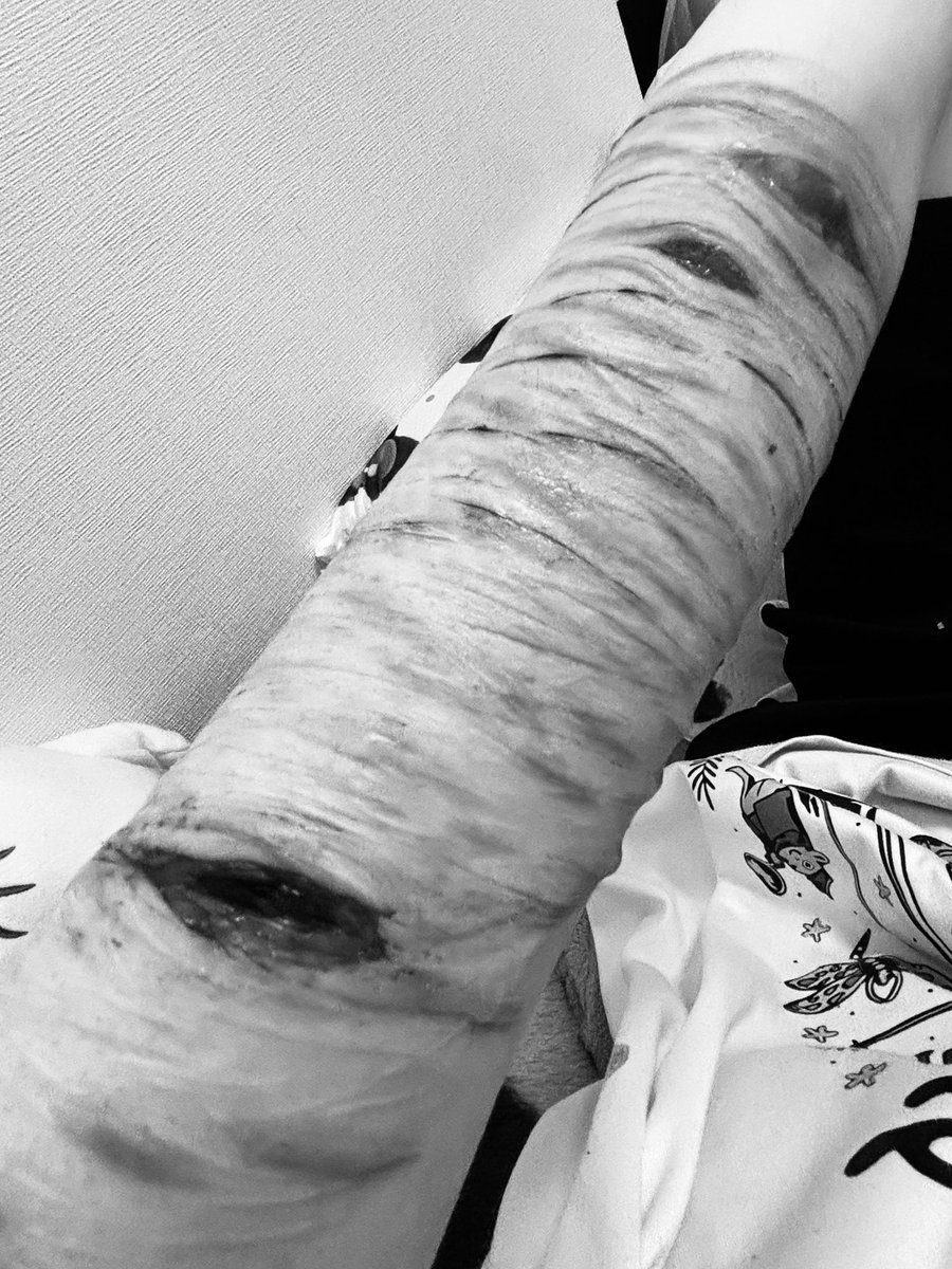 Ahhgftc's tweet photo. #slittwt #shedtwt #shtwt #cuttwt #988twt
It's just special effects makeup from a gore movie scene. ALL FAKE⛓️‍💥 https://t.co/ZLUZyaDXkW