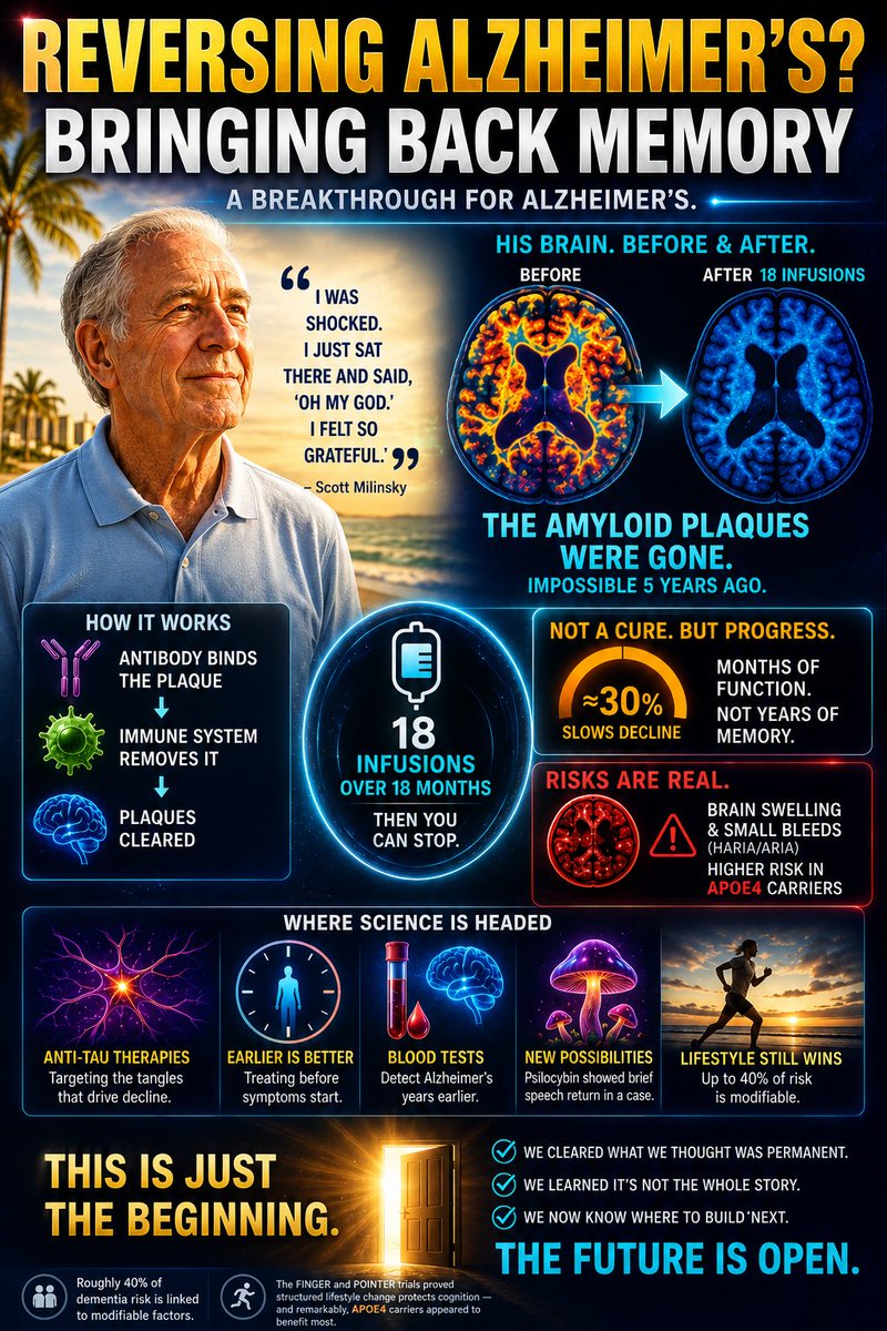 afshineemrani's tweet photo. I'm a cardiologist. A 79-year-old grandfather in Pompano Beach just had something happen that was impossible five years ago.

Scott Milinsky watched Alzheimer's take his father — the memories, then the man. When he got his own diagnosis, his first thought was: I'm going to be like my father. It's terrifying to die that way, not knowing who you are.

He enrolled in treatment with Kisunla. Eighteen infusions over a year and a half.

Then they scanned his brain.

The amyloid plaques were gone.

"I was shocked," he said. "I just sat there and said, 'Oh my God.' I felt so grateful. It was overwhelming."

I want to sit with how extraordinary that is — and then tell you the truth about what it does and doesn't mean, because you deserve both and almost no one gives you both.

What actually happened in that brain.

For over a century, amyloid plaque was the defining pathology of Alzheimer's — the thing you found on autopsy that confirmed the diagnosis. We could see it. We could not touch it.

These drugs are monoclonal antibodies that cross into the brain, bind the plaque, and recruit the immune system to remove it. In the pivotal trial, most patients achieved amyloid clearance within 18 months — and donanemab is unusual in that once your plaques are cleared, you can stop the infusions. You finish. Very few treatments in chronic neurologic disease work that way.

Twenty years ago, clearing amyloid from a living human brain was a theoretical goal in grant applications. It is now something a community hospital in Broward County does to more than sixty patients.

Now the honest part, and his own doctor said it plainly.

This is not a cure, and it is not reversal.

Removing the plaque slows the decline — roughly 30% in the trials, meaning the disease still advances, just more slowly. Patients gain months of function, not years of restored memory. Nobody in these trials got their old mind back.

And here is the deep puzzle at the center of the field: amyloid clearance and cognitive benefit don't track as tightly as we expected. Plaque was cleared almost completely, and the clinical benefit was real but modest. Which tells us amyloid is part of the story and not the whole story.

The other half is tau — the tangles that form inside neurons and correlate far more closely with actual cognitive decline. These drugs don't touch tau. That's precisely why the entire field is now racing toward anti-tau therapies and combination approaches.

And the risks are real. ARIA — amyloid-related imaging abnormalities, meaning brain swelling and small bleeds — occurs in a meaningful minority. Most cases are asymptomatic and resolve, but serious events happen and there were deaths in the trials. APOE4 carriers, especially those with two copies, face substantially higher risk — which is why genetic testing before treatment now matters enormously.

This requires MRI monitoring, careful patient selection, and honest counseling. It is not for everyone with memory complaints.

So where does that leave us?

Somewhere genuinely important, and I say this as a physician who has watched families destroyed by this disease.

For twenty years we had nothing that touched the biology. We had drugs that mildly buffed the symptoms while the disease proceeded exactly as it would have anyway. Every trial failed. The field was written off.

Now we can remove the defining lesion from a living brain — and we've learned that doing so alone isn't enough. That is not a failure. That is how science actually works. You get the first tool, you find its ceiling, and the ceiling tells you where to build next.

Anti-tau agents are in trials. Earlier intervention — treating people who have plaque but no symptoms yet — is being tested right now, on the theory that we're arriving decades too late. Blood tests can now detect Alzheimer's pathology years before memory fails. And a case report this year described psilocybin briefly restoring speech in a woman who hadn't spoken in years, suggesting some capacity may be disconnected rather than destroyed.

And the intervention with the best evidence available today remains unglamorous and free: exercise, sleep and treating sleep apnea, blood pressure control, metabolic health, hearing aids, and social connection. Roughly 40% of dementia risk is linked to modifiable factors. The FINGER and POINTER trials proved structured lifestyle change protects cognition — and remarkably, APOE4 carriers appeared to benefit most.

Milinsky's own words were the wisest thing in the article:

"This is a game changer, and there's going to be more game changers. This is just the beginning."

He's right on both counts.

We have not reversed Alzheimer's. But for the first time in the history of medicine, we changed something inside a living brain that everyone assumed was permanent.

That's not the finish line.

It's the first time the door moved