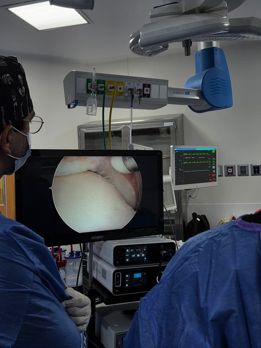 Torlsteinacst's tweet photo. Paciente con inestabilidad lateral de tobillo, el cual se le realiza artroscopia para revisión de tobillo y valoracion de probable pinzamiento anterior 

#med #medicine #tyo #orthopedicsurgery #aorenferencesurgery #traumatology #pieytobillo #footandankle #arthroscopy https://t.co/O5yTU1CVWA