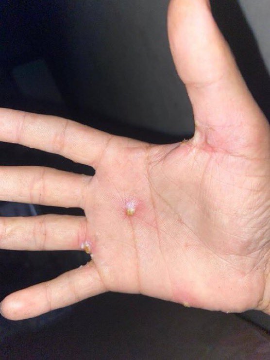 yazanomarrr's tweet photo. I beg you, please don’t ignore me. 😭🙏

I beg you, please don’t ignore me. 😭🙏

I beg you, please don’t ignore me. 😭🙏

BEG YOU, PLEASE DON’T SCROLL PAST. THIS IS URGENT. 

My brother and I are suffering from a bacterial infection. We have severe stomach pain and chronic diarrhea due to contaminated water, polluted air, and unsafe food. Please help us get the treatment we need by donating and sharing our story to help save us.

https://t.co/TigcqLHh01