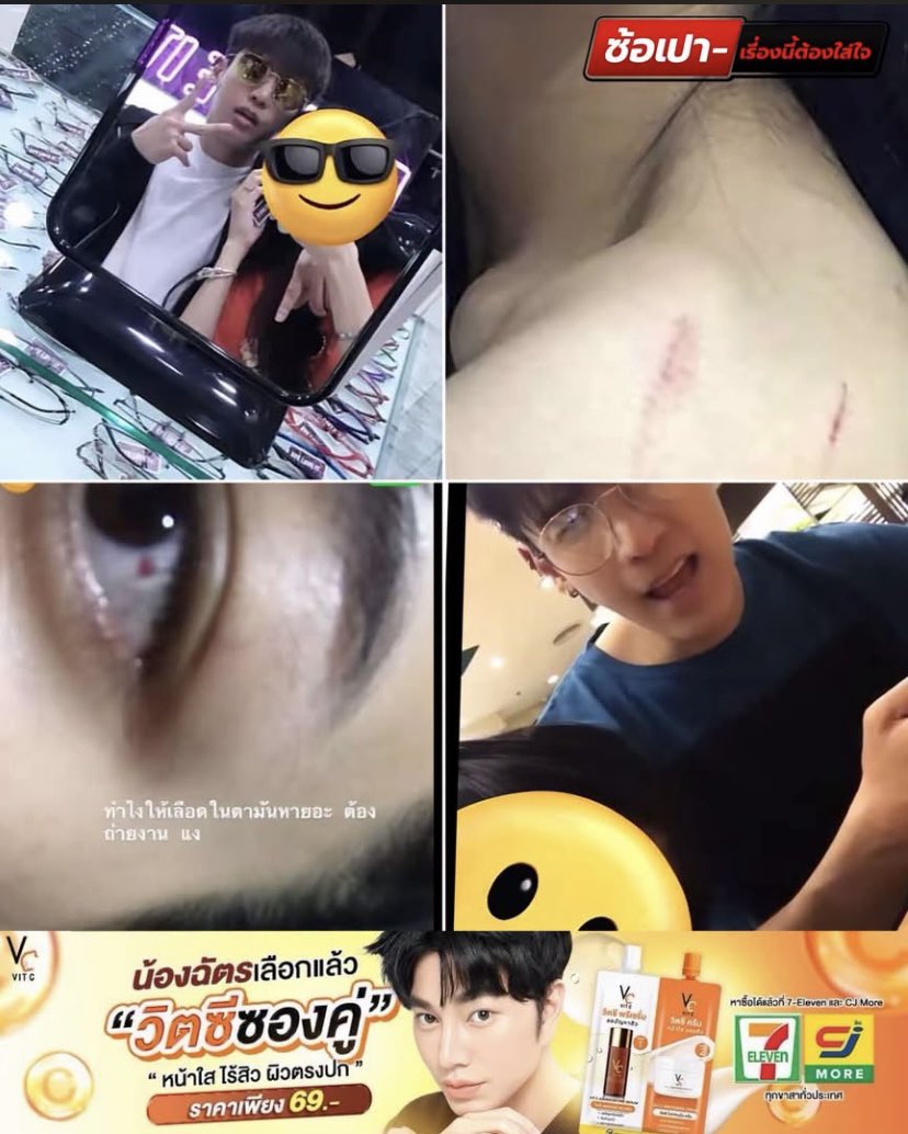 piyada_369's tweet photo. ผู้เสียหายที่โดนยูทูปเบอร์หัวสีทำร้ายร่างกายโผล่มาอีก 1 ราย เคยคบกันหลายปีก่อน

📍ยูทูปเบอร์หัวสีพยายามขับรถชน 
📍ขู่เอามีดแทง (พยานคือเพื่อนอยู่ในรถด้วย)
📍โดนตีจนเลือดในตาออก 
📍โดนตบกลางตลาด 

‼️มีรูปยืนยันว่าเคยคบกันจริง‼️

#อู๋จุน #oaujunhiend #โหนกระแส https://t.co/Qi09s7D6Nq