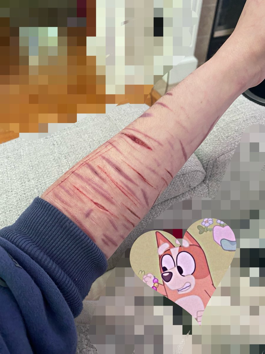 daybrrrr's tweet photo. what happens when i’m cold 
purple sfx makeup  fake arm #988twt https://t.co/FKOFcAGGLp
