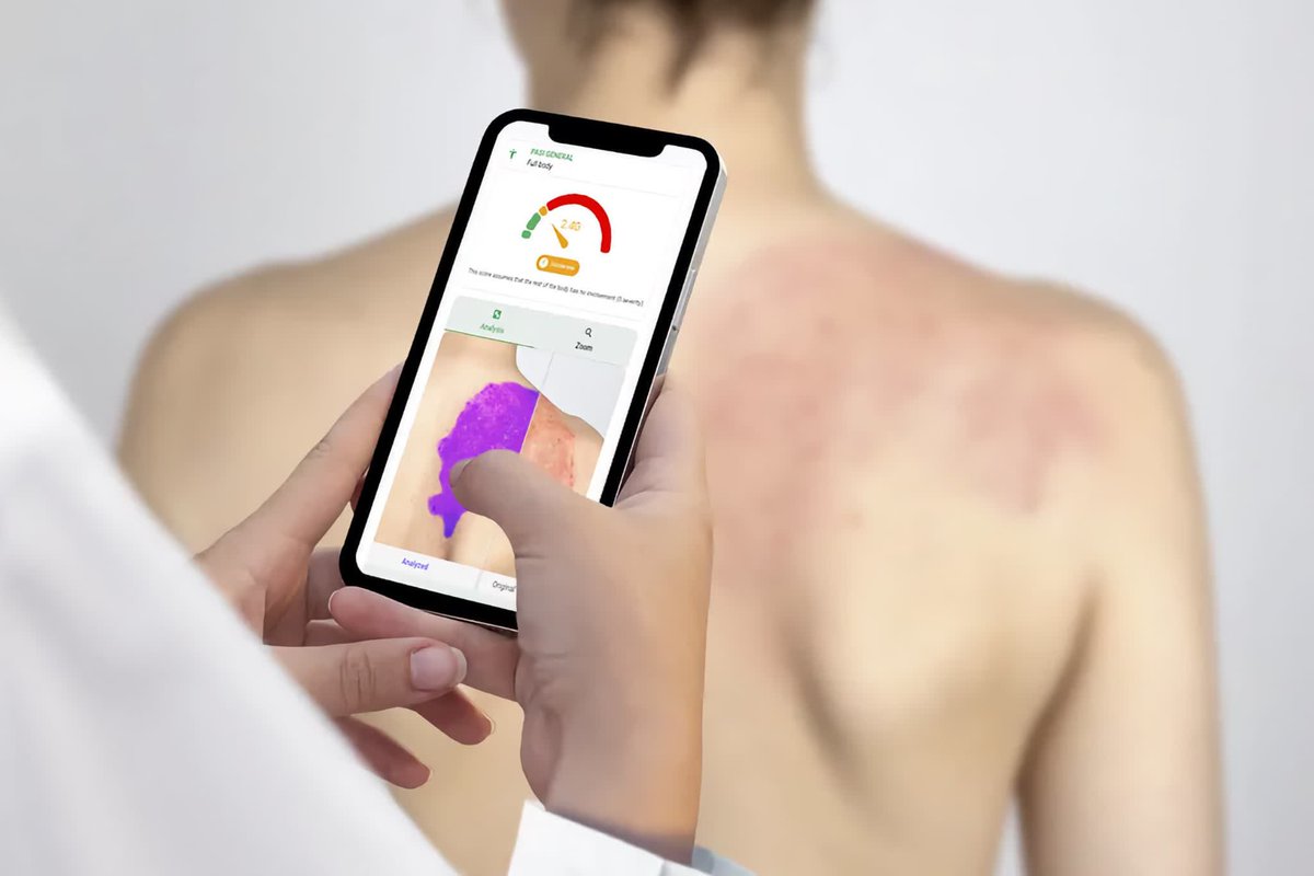 JournalDuGeek's tweet photo. Une simple photo de la peau pour réduire la file d’attente chez le dermato https://t.co/Lkkc6DDGJz #news https://t.co/jz5cPXLd0K