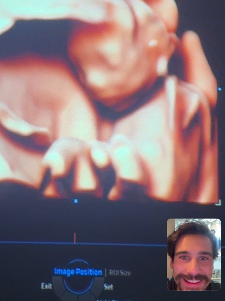 SabrinaSato's tweet photo. Nicolas, meu amor, seu primeiro Dia dos Pais… Mas, pensando bem, não é o primeiro, né?

Você já era pai no sonho, no desejo, no cuidado. E agora, mesmo com o nosso bebê ainda no forninho, você já é pai dele há muito tempo: desde quando ele era só um sonho nosso.

Depois de tudo que vivemos até chegar aqui, ver esse sonho se realizando ao seu lado é ainda mais especial. Tenho certeza de que você vai ser um pai muito incrível. Feliz Dia dos Pais, meu amor! Te amo infinito ❤️