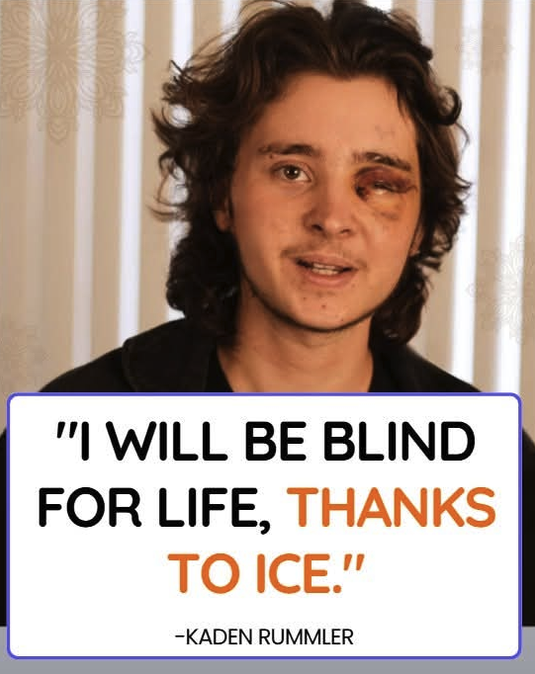 AntiLeftMemes's tweet photo. Was ICE justified in what they did to this leftist protester who was throwing stuff at them ??

A. YES
B. NO https://t.co/MxLqnUafC4