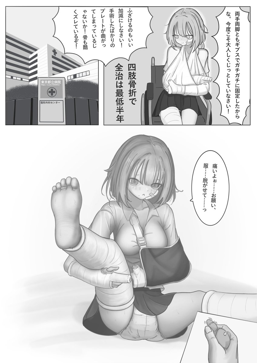 OAO0412's tweet photo. 百合ギブスフェチの骨折日記 漫画全編 https://t.co/p7UyU9jHCH