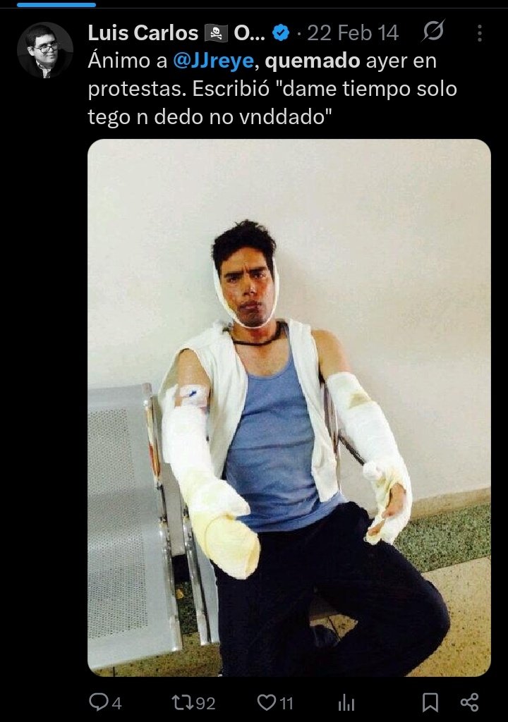 ReinadoVen's tweet photo. @POTUS @realDonaldTrump @SpeakerJohnson @SecRubio @SenRickScott @DeputySecState @WHAAsstSecty @RepTimMooreNC @USAmbMex @USAmbUN @berniemoreno @SecScottBessent @JuanPGuanipa @carolina_amesty @mazucooficial @Simonovis His men🚔stalked,burned,Took&amp; Tortured me,on top of suspended,from my Univ.forDir.Orders of Mig.RodríguezTorres.
Aldo I do not resent him if Delcy has him w.her,we should we allowed of having @USMC here in SWZulia working alongside @AbDeLaEspriella against FARC&amp;ELNs inJ.M.Semprún https://t.co/CcjWIZuVFU