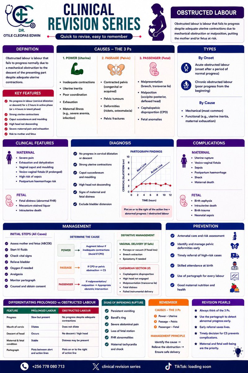 DrOtile_CE's tweet photo. 🚨 OBSTRUCTED LABOUR , A MUST-KNOW!

When labour just isn’t progressing despite good contractions… 🚩
Think obstruction.

👀 Spot it early.
⚡ Act fast.
❤️ Save two lives.
#ClinicalRevisionSeries #Obstetrics #ObstructedLabour https://t.co/o1mo5zuItW