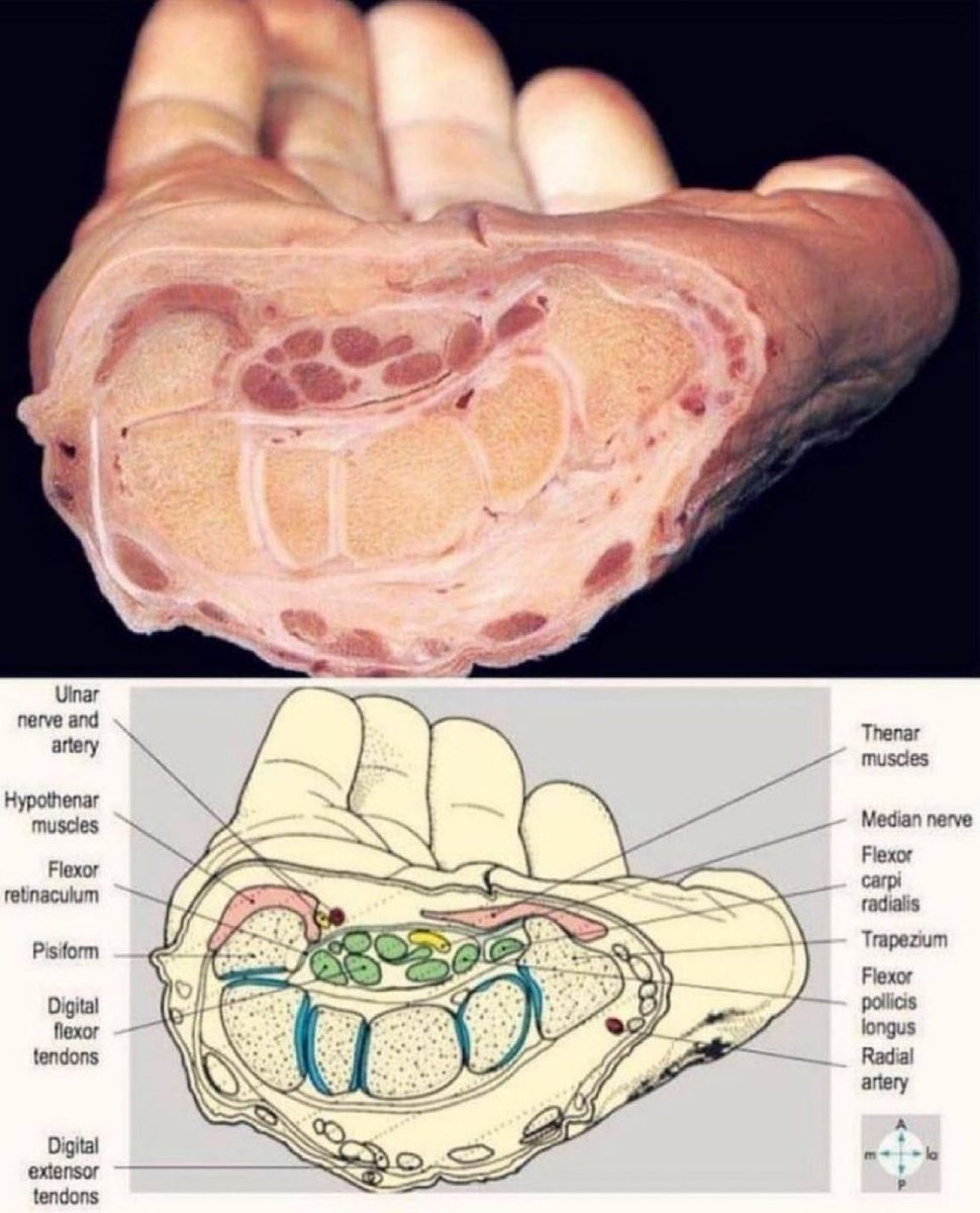 medicosityy's tweet photo. Wrist anatomy, between reality and books. https://t.co/xQQt4wetkw