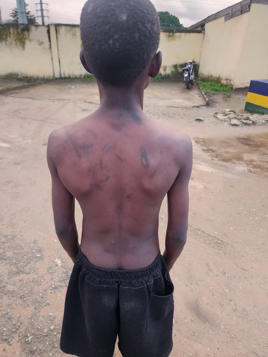 QueenUjunwa1's tweet photo. Chukwuka has lived with his aunt (mom's sister) for a year and 8 months now ...

His statement is at the station, and I believe that it will be handled properly ...

I'll give us more updates in due time, but for now, he is currently at the hospital in ABA, where we are making sure he gets proper treatment....

He is 16 and takes care of his aunt's child and also cooks and serves in her mama's pot...

The matter was reported at the Osisoma division, and the aunt is with them today before we leave for the hospital. 

©️Uwaoma Susan Arthur