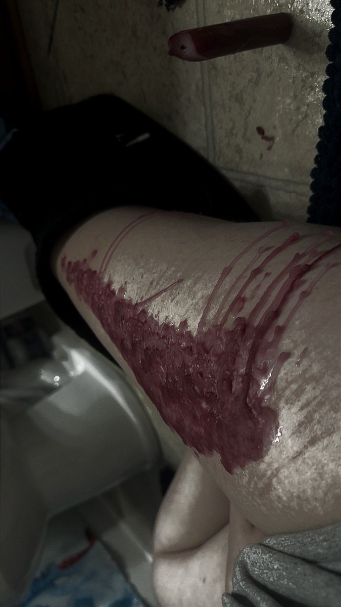 AlexAngelll444's tweet photo. More wax dripped on my leg https://t.co/LPc7MMoU0C