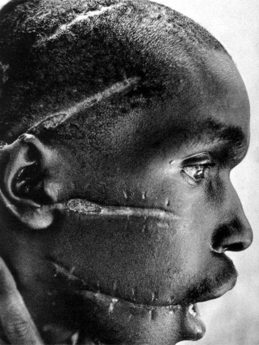 TheNameofWar's tweet photo. Portrait of a Tutsi survivor of the 1994 Rwandan genocide, his face scarred by machete wounds inflicted during the mass killings carried out by Hutu extremist militias https://t.co/mFluVyhgyt