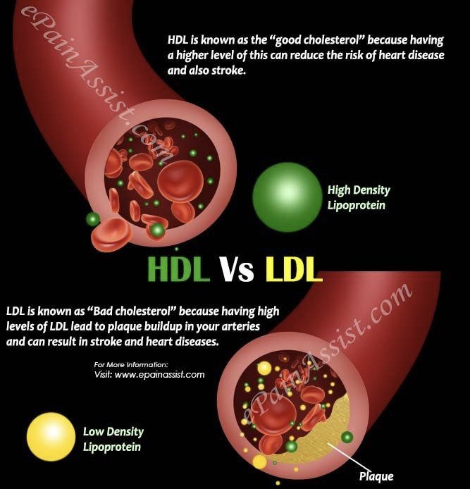 _Rose_Lab's tweet photo. وش ال��رق بين HDL و LDL؟ 👇
🔴 LDL | الكوليسترول الضار يسمونه «الضار» لأنه ممكن يتراكم في جدران الشرايين مع الوقت، ويرفع خطر تضيقها وتصلب الشرايين. 📌 الأفضل يكون منخفض.
🔵 HDL | الكوليسترول الجيد يساعد على نقل الكوليسترول الزائد من الشرايين للكبد عشان يتخلص منه الجسم. https://t.co/TiGyiDMzEI