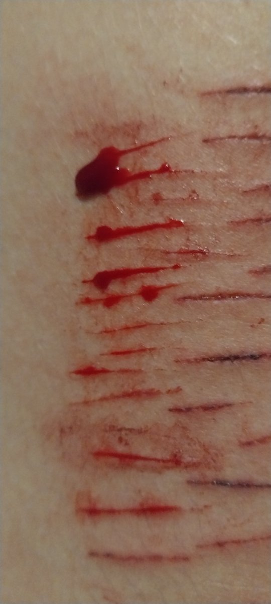 butcher2hl's tweet photo. Someone tell me how to do proper styro makeup why are they so inconsistent

#sfxmakeup https://t.co/LYwgmpqefO