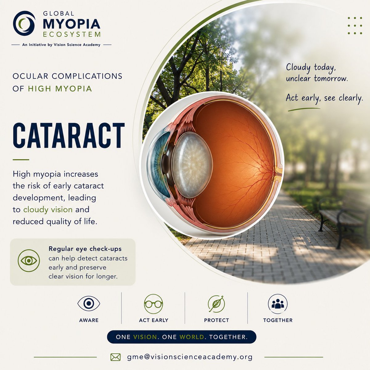 gme_vsa's tweet photo. ☁️ Cataracts may develop earlier in eyes with high myopia.
High myopia is associated with an increased risk of earlier cataract formation, causing cloudy vision, reduced contrast sensitivity, and difficulty with daily activities.
#GlobalMyopiaEcosystem #HighMyopia #Cataract https://t.co/sUjBUxqraI