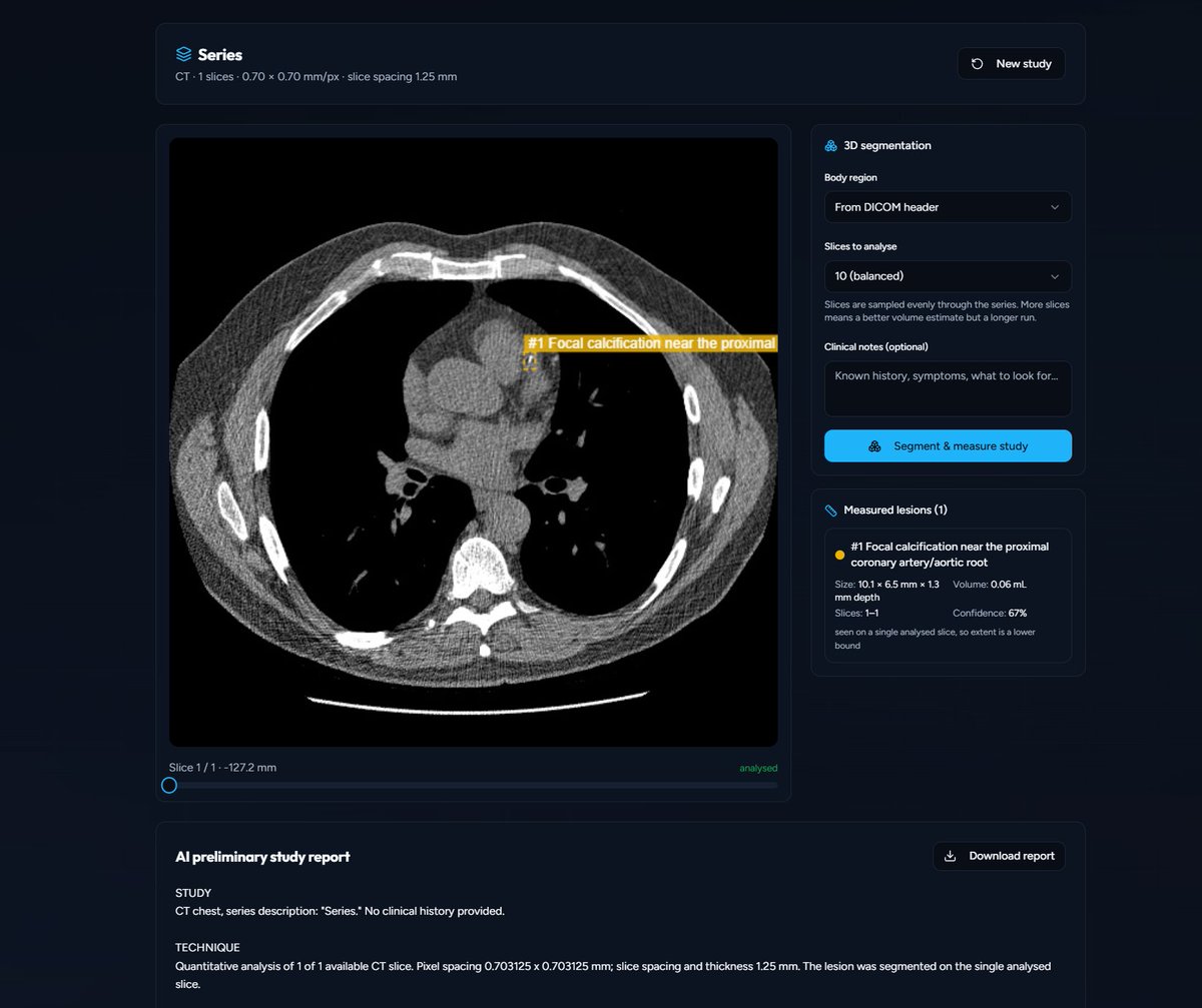 scanwithagera's tweet photo. Agera now supports DICOM Studies.

You can upload and review complete medical imaging studies in one place. Built to make AI-assisted imaging analysis more structured, contextual, and clinically relevant.

We’re continuing to build Agera as an intelligence layer for medical imaging.