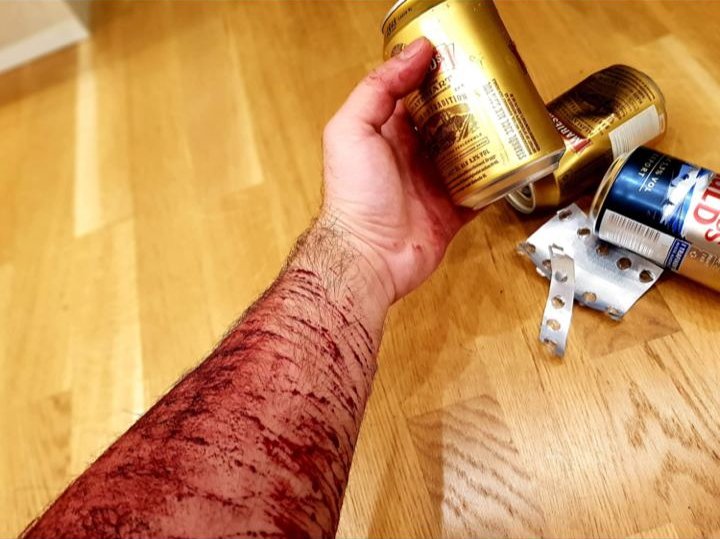 MXvcn79900's tweet photo. Andreas Ronnberg photos of ////
I saw them a while ago, so I decided to post them since I can't seem to find the original post
⚠️CAUTION, IS JUST MAKEUP AND SPECIAL EFFECTS!⚠️
#shrtwt #subtwt #ouchietwt https://t.co/rqnNJ3CIO9