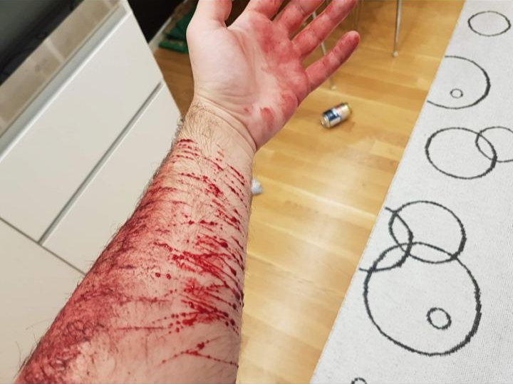 MXvcn79900's tweet photo. Andreas Ronnberg photos of ////
I saw them a while ago, so I decided to post them since I can't seem to find the original post
⚠️CAUTION, IS JUST MAKEUP AND SPECIAL EFFECTS!⚠️
#shrtwt #subtwt #ouchietwt https://t.co/rqnNJ3CIO9