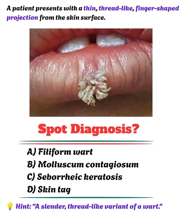 DoctorMed0's tweet photo. Spot your diagnosis..?? https://t.co/8EL1QjrcKy