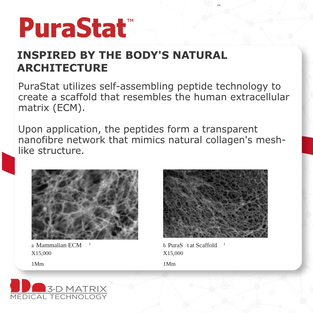 3dm_emea's tweet photo. PuraStat forms a transparent nanofibre scaffold that resembles the structure of the human extracellular matrix (ECM).
PuraStat creates a biomimetic scaffold that supports haemostasis whilst maintaining visibility of the treatment site.
#PuraStat #3DMatrixEMEA #RADA16 https://t.co/3IHzBanHaG