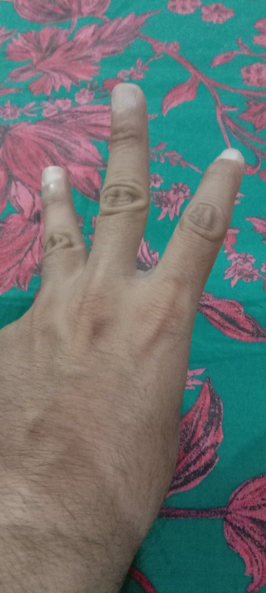 cooking19820's tweet photo. #watchersEverywhere in Pakistan https://t.co/2EIEpiZd5G