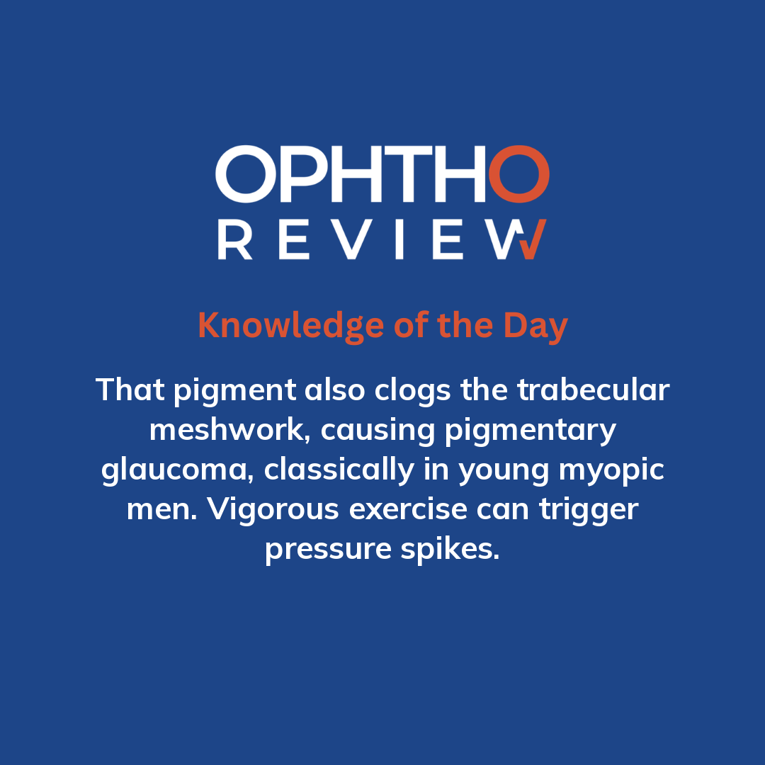 ophthoreview's tweet photo. Pigment form a vertical spindle

#ophthoreview #ophthalmology #ophtho #ophthalmologyresidency #ophthalmologist #surgicaleducation #medicaleducation #meded #surgery #medicalstudent #medicine #medicalschool #resident #residency https://t.co/Kw8d0DuFqs