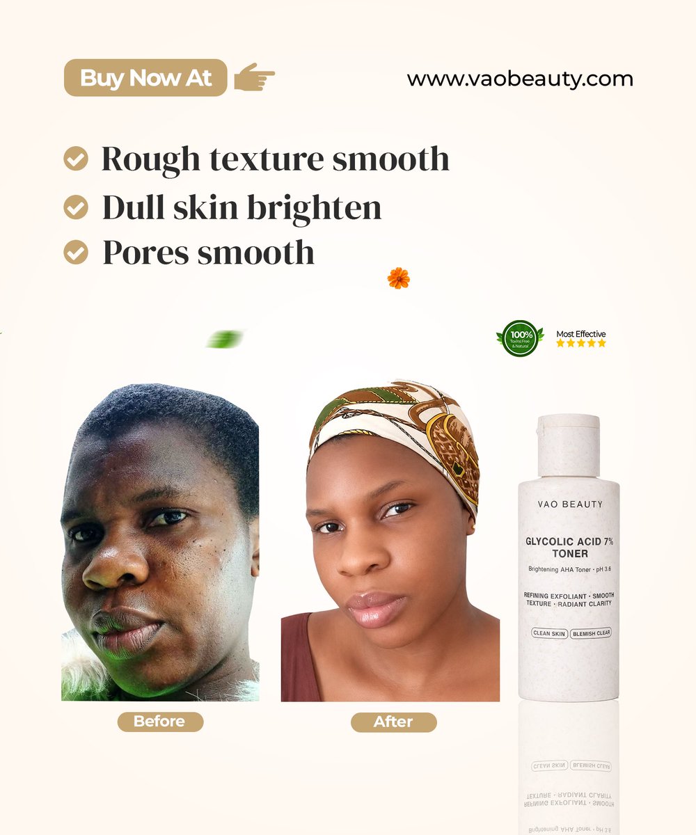 vaobeauty's tweet photo. Dull skin, Rough Texture, Pores and Uneven skin tone fades and get erased when apply daily. 

Buy now on https://t.co/hc8a8uHxUw

#DullSkin #roughtexture #pores #unevenskintone https://t.co/6FLl91MBPH